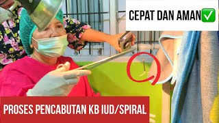 PROSES PELEPASAN KB IUD/SPIRAL, APAKAH TERASA SAKIT⁉️