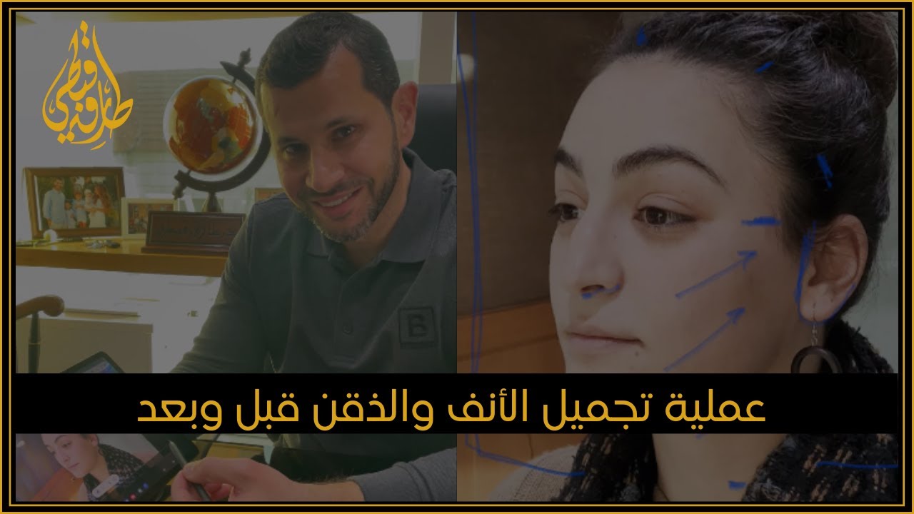 مركز الدكتور طارق قبطي لجراحة التجميل | الفرق بين شد الوجه الكامل والمصغر ورفع الحاجب