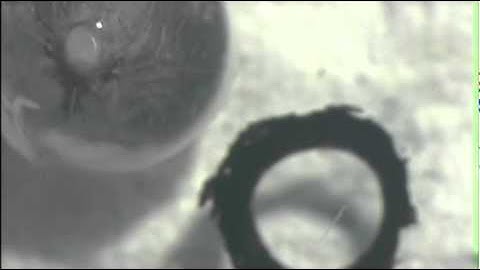 Retina_Dissection.mp4