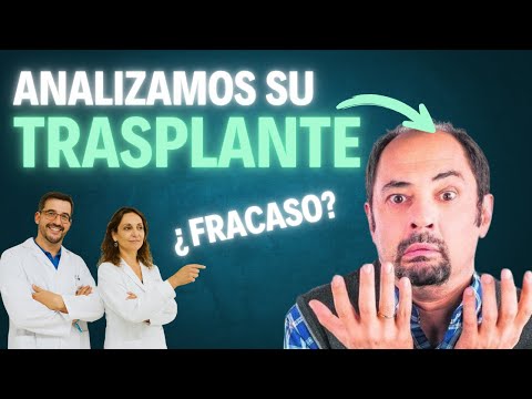 🔵 WORST HAIR TRANSPLANT: "THE ONE THAT IS COMING"