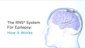NeuroPace: How the RNS System Works