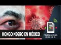 Hongo negro en México: qué es, síntomas, cómo se contagia | Mientras Tanto en México