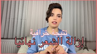 ازالة الشعر نهائيا تجربتي الشخصية | نتيجة خرافية