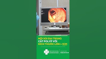 NỘI SOI ĐẠI TRÀNG CẮT POLYP VỚI KÍCH THƯỚC LỚN HƠN 1CM | BVDK SÀI GÒN NHA TRANG