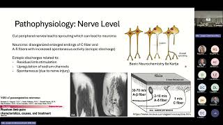 Phantom Limb Pain (PLP): Overview and Future Directions