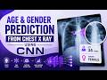 Age and Gender Prediction from Chest X Ray using CNN