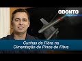 Cunhas de Fibra na Cimentação de Pinos de Fibra | Leonardo Muniz