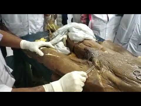 Dissection of femoral triangle & adductor canal camera iphone 8 plus apk