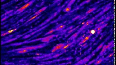 Calcium signals in muscle cells
