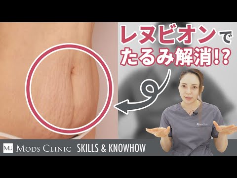 皮膚のたるみを引き締める治療「レヌビオン」とは／ボァイエ真希子 医師｜Mods Clinic（モッズクリニック）