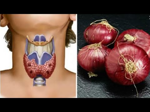 WHAT WILL HAPPEN IF YOU SLEEP WITH RED ONION AROUND YOUR NECK!