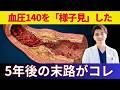 【警告】血圧140を放置した5年後の末路。血管の中はこうなっています