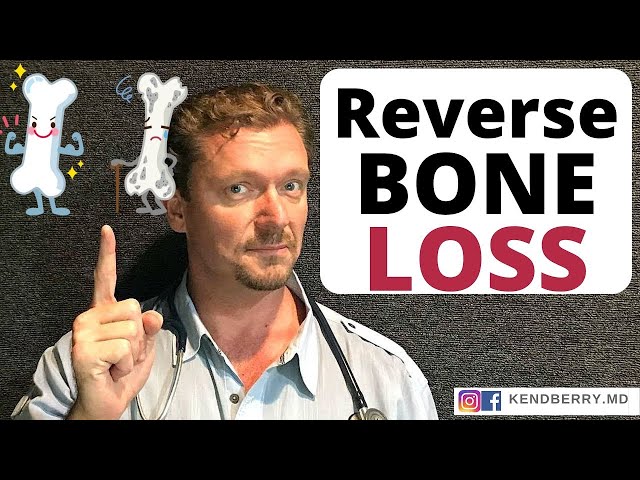 Reverse/Prevent OSTEOPOROSIS (Get Stronger Bones) 2024 class=