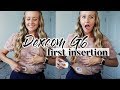 MY FIRST DEXCOM G6 SENSOR INSERTION // my reaction