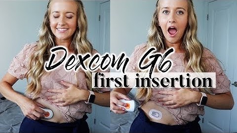 MY FIRST DEXCOM G6 SENSOR INSERTION // my reaction