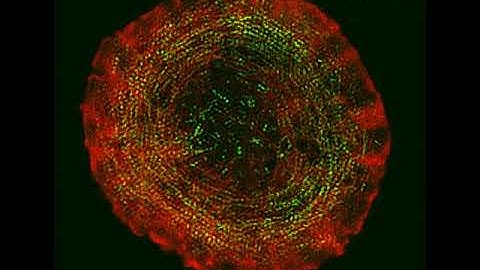 Actin and Actomyosin Networks in T Cells: Supplemental Video 2