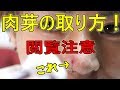 【閲覧注意】ピアスを開けるとできる"肉芽"の取り方！