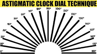 Astigmatic Clock Dial & Fogging Technique | AK Khurana | Dr Saud Javed