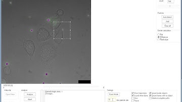 Able Particle Tracker: Tracking a fluorescent micro particle inside of a living cell