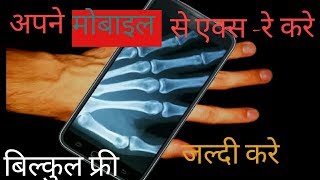एक्स -रे करना हुआ बिल्कुल आसान अपने मोबाइल से एक्स-रे करे screenshot 3