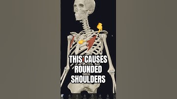 STOP Blaming This Muscle for Bad Posture ❌