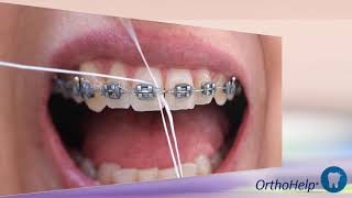 Gota #27 - COMO UTILIZAR PASSA-FIO OU SUPERFLOSS screenshot 3