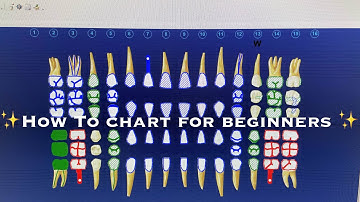 DENTAL CHARTING AND CODING FOR BEGINNERS