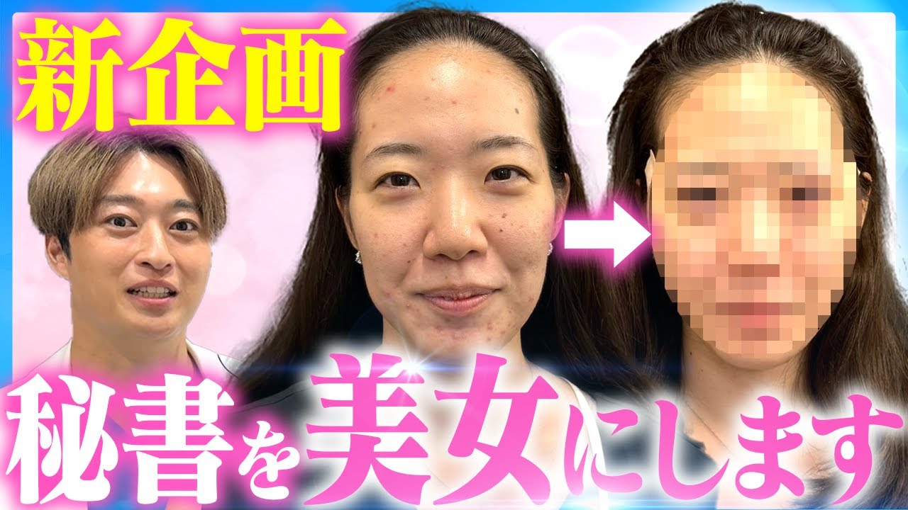 【糸リフト】【二重埋没】ダウンタイムも公開！廣瀬の秘書を爆美女にします