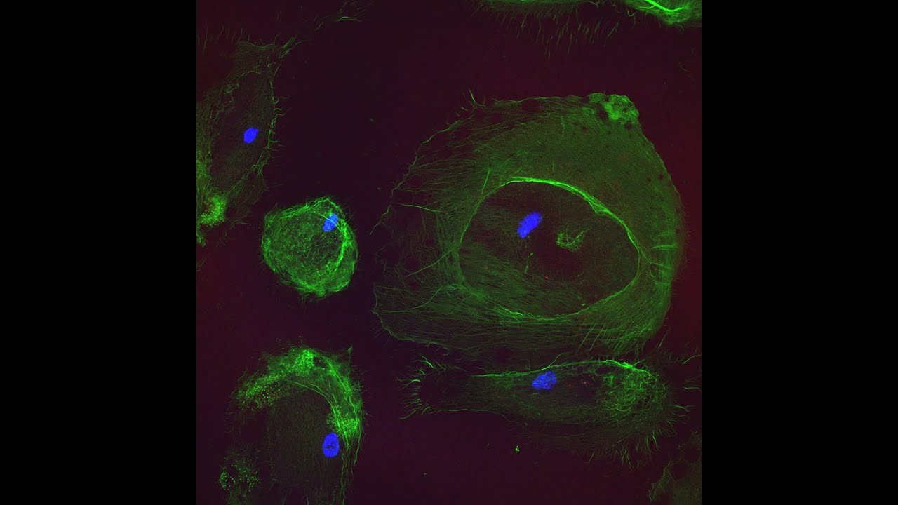 IFN Gamma Treated Macrophages