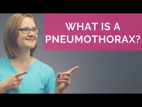 Wideo: Co to jest odma płucna?