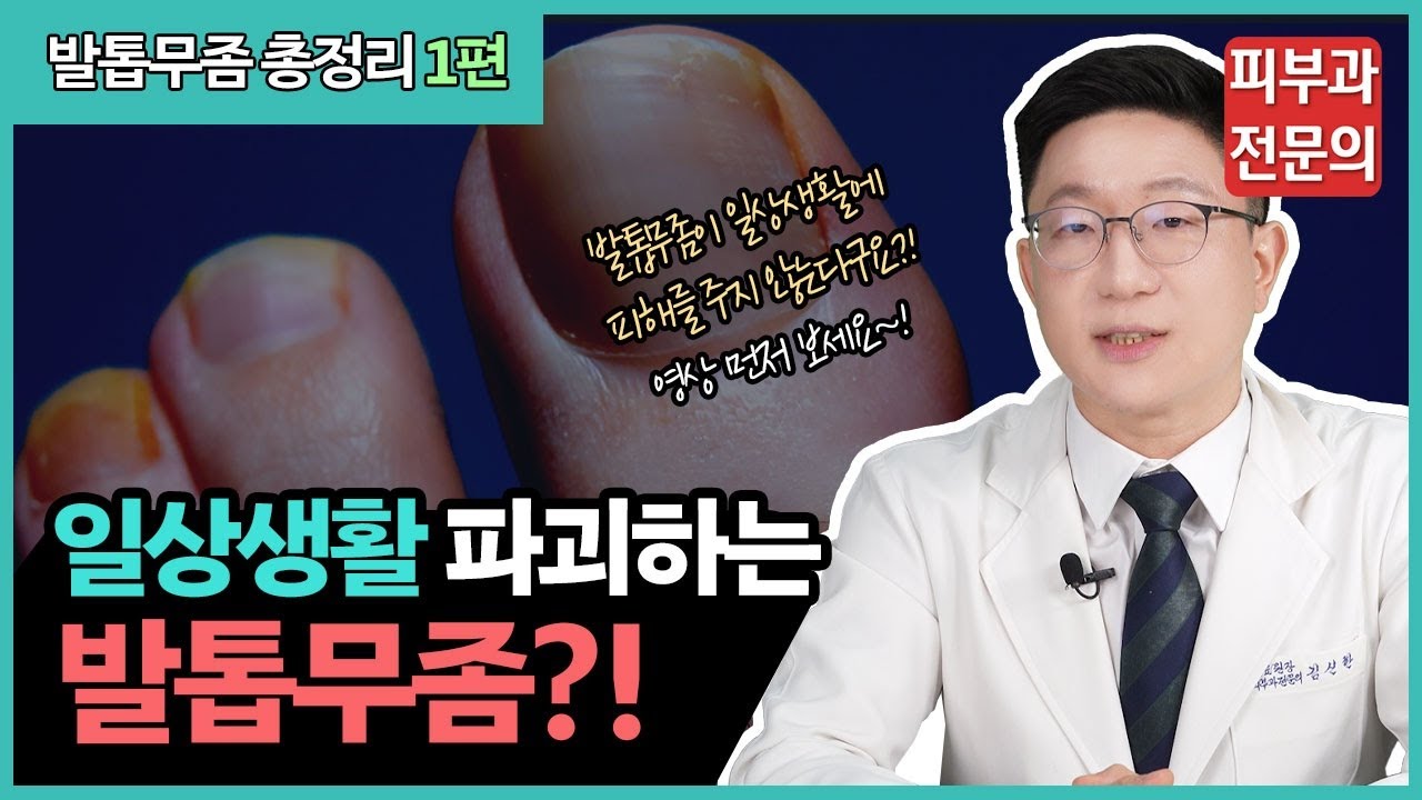 발톱무좀이 완치 안 된다고 생각한다면❓ 이 영상 먼저 보세요‼