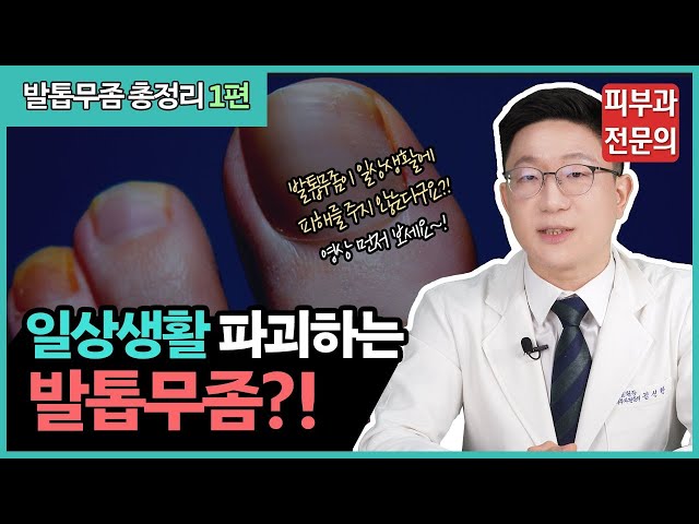 발톱무좀이 완치 안 된다고 생각한다면❓ 이 영상 먼저 보세요‼