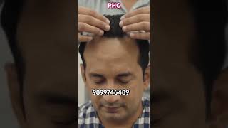 Best quality Hair Patch for Men | Permanent Hair Patch Delhi | #wigs #hairpatch