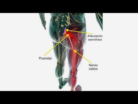 Remédios caseiros para Inflamação do Nervo Ciático