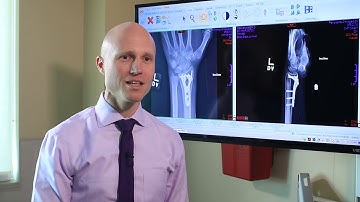 Broken Wrists: Fracture Types, Treatment Options, & Recovery - Dr. Froelich