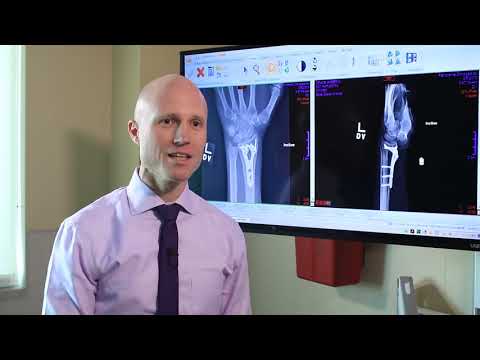 Video: Displaced Wrist Fracture - Symptoms, Treatment And Rehabilitation