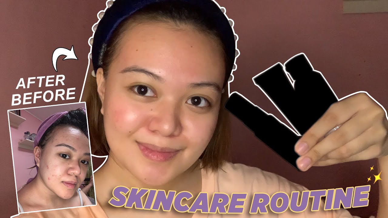 Current Skincare Routine + My Acne Journey