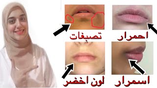 كيفية ازالة السواد والاسمرار حول الفم/ حل نهائى لاسمرار ولسواد حول الفم والشفايف في ايام ..