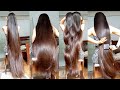 मेरे बाल 2 दिन में झड़ना बंद हो गई|| 100% Effective|| Control Hairfall permanently||Shoking Result 😱