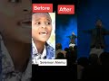 Solamon Alemu Before After Faarfannaa Shorts Solamon Alemu Before After Faarfannaa Shorts