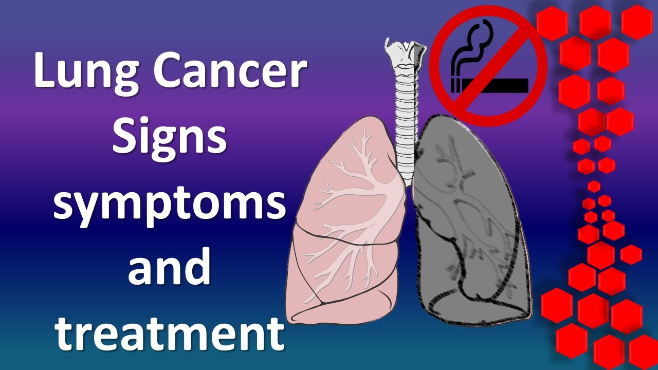 10 Warning Signs Of Lung Cancer 