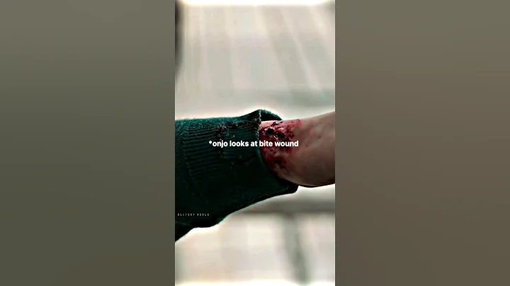 pov: onjo is immune to virus 🤯 #allofusaredead #onjo #shorts #cheongsan #virus #zombiesurvival #pov