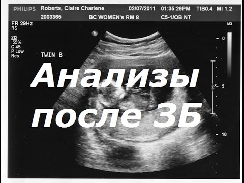 Анализы после замершей беременности.