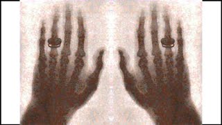 17.4.1 X-Ray Spectrum