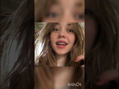 كل ذا الجمال وقاعدين يتنمرو على تقويم الاسنان Shorts