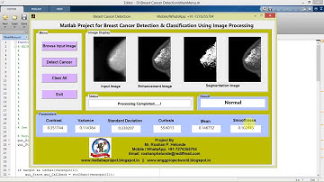 Breast Cancer Detection & Classification using Image Processing Matlab Project