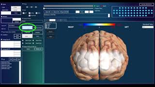 Soterix Medical Presents Nirsit Eye Pc Software