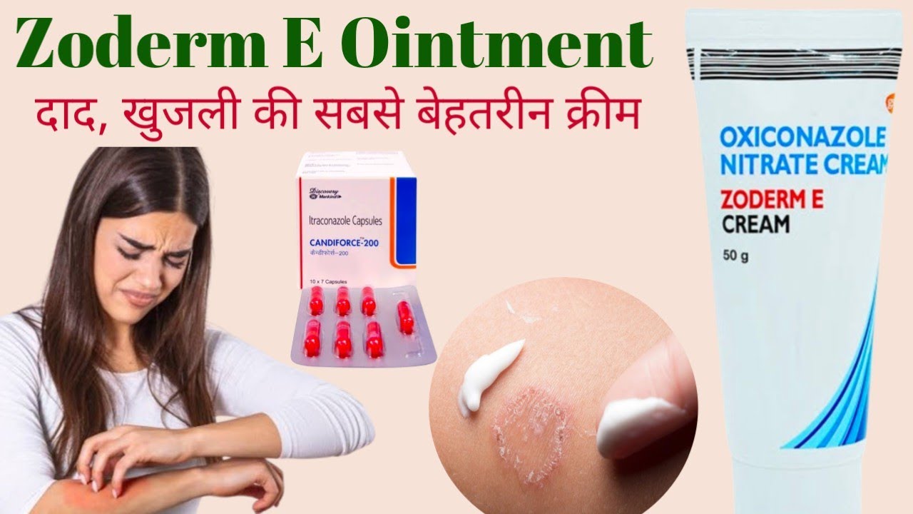 दाद खाज खुजली का घरेलू नुस्खा वीडियो | Fungal infection | Fungus | Oxiconazole Ointment |Beauty Tips