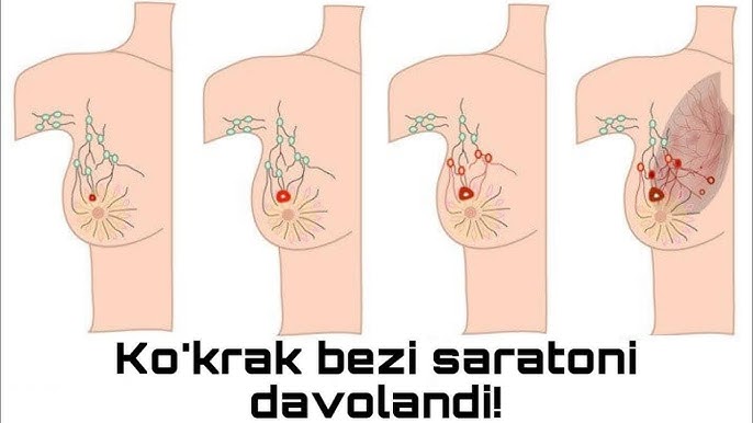 Nastya Monpasier Katya Gorlova porno video Natalya Bochkarevaning yalangoch fotosuratlarini koring