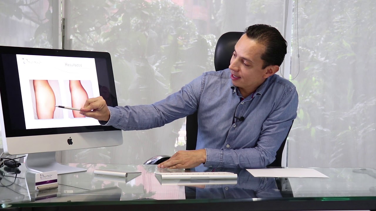 Aumento de glúteos con implante, Capítulo II.